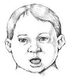 Голова дауна. Дауны лицо. Иллюстрации для детей даунов. Дети дауны рисунок. Лицо детей даунов.
