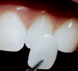 vinir2 дент идеал луначарского 13 телефон